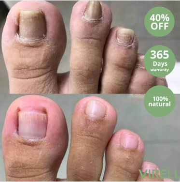 Nail Care Pen