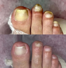 Nail Care Pen