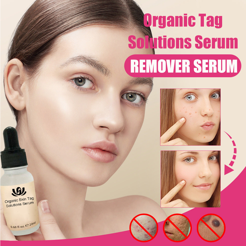Organic Skin Tag Remover Serum - All Natural For Warts
